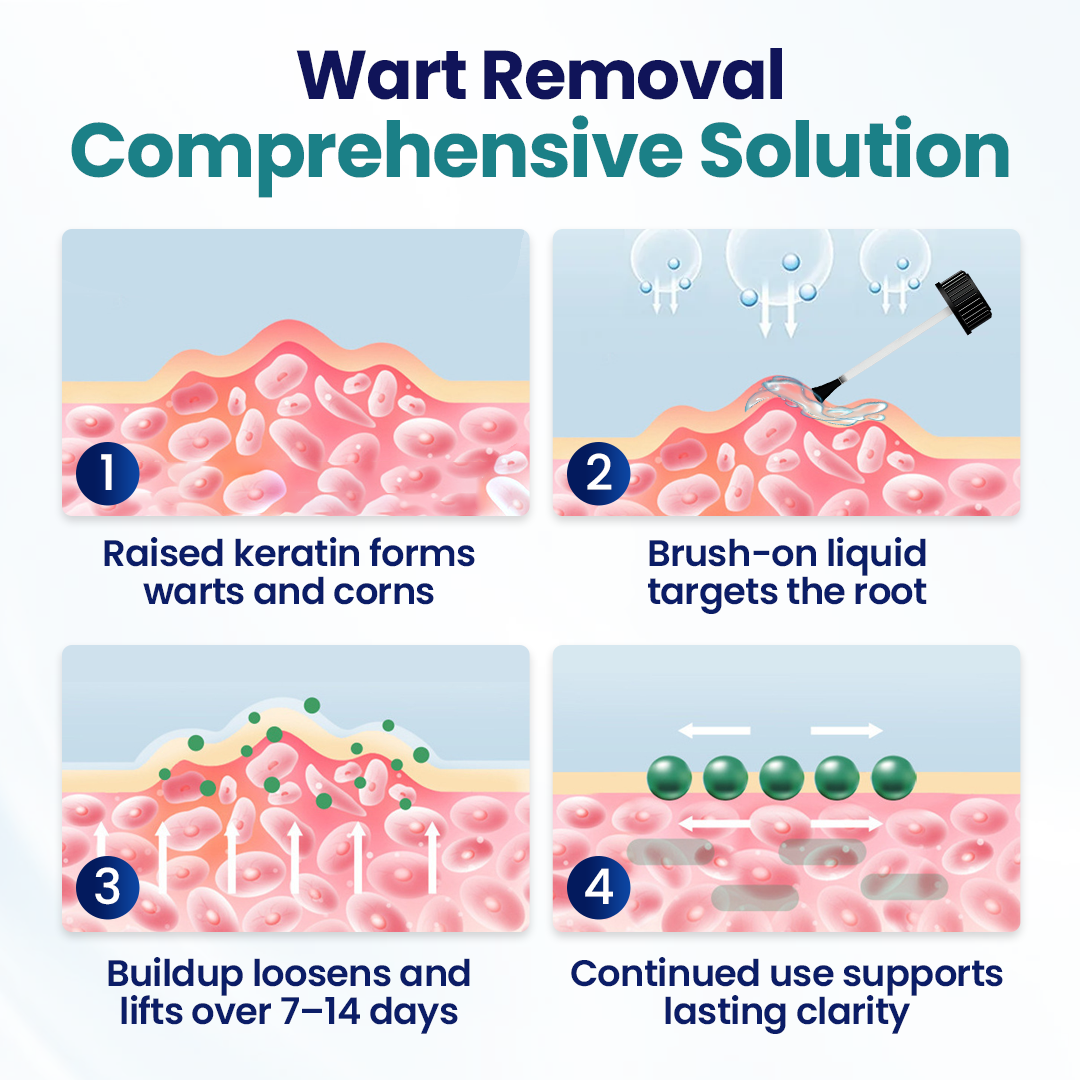 Timilk® WartLift Corn Removal Liquid (new)