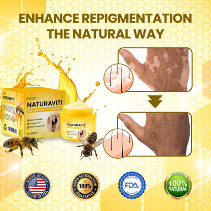Timilk® NaturaViti Bee Venom Vitiligo Cream