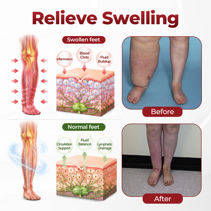 Timilk® SwellVeil Leg Circulation Cream