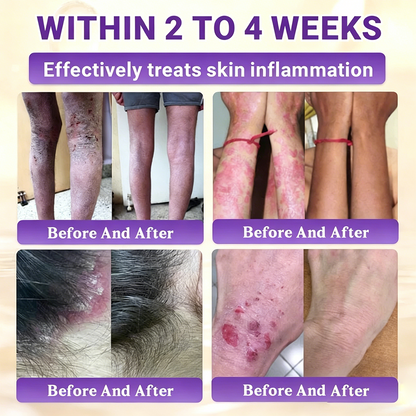 Timilk® BioColla DermaRenew Cream（usa）
