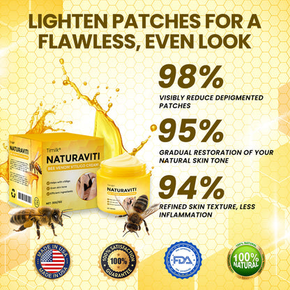 Timilk® NaturaViti Bee Venom Vitiligo Cream