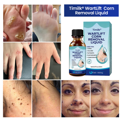 Timilk® WartLift Corn Removal Liquid (new)